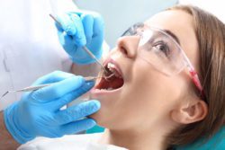 tooth extractions 