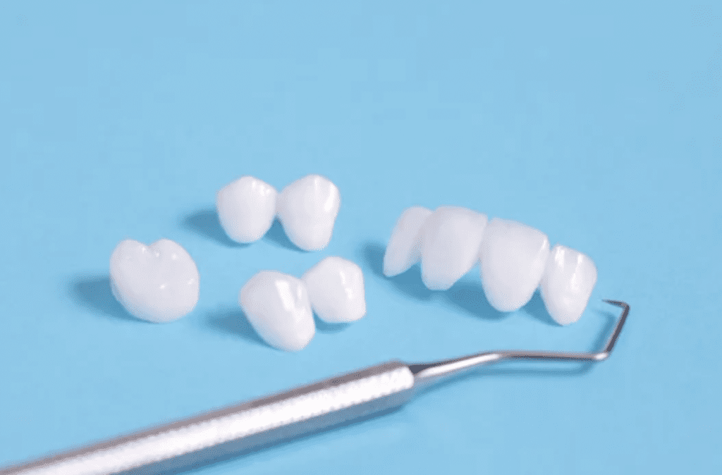 image of several porcelain veneers sitting on a light blue background with a dental scaler cosmetic dentistry dentist in Amherst New York