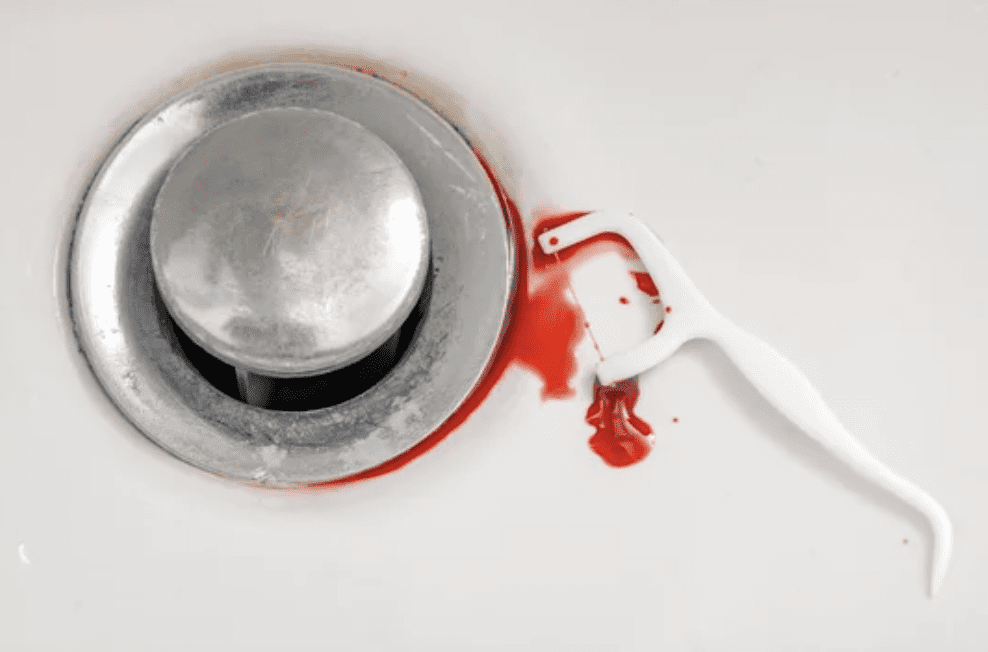 Image of a plastic flossing utensil in the bottom of a white sink with blood gum disease treatment for gum disease dentist in Amherst New York
