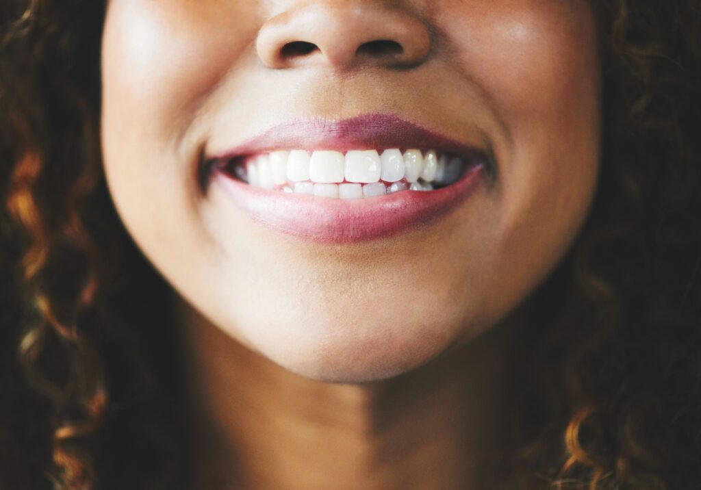 TEETH WHITENING in AMHERST NY is only as effective as your upkeep routine