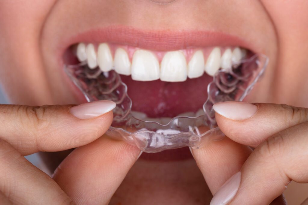 INVISALIGN in AMHERST NY can help get your teeth smile ready for the holidays