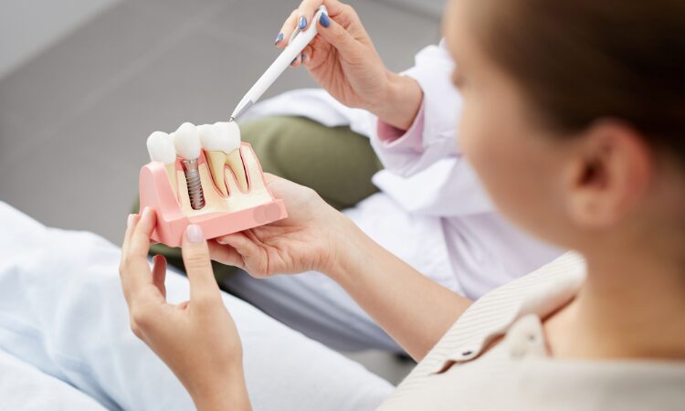 The timeline for dental implants varies for each individual and depends on several factors, including oral health and bone structure.